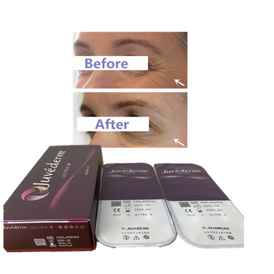 Juvederm 2ml Ultra3 Ultra4 Voluma Kwas hialuronowy Wypełniacz skórny Wypełniacz ust 24mg