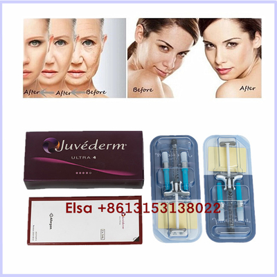 Produkty estetyczne Juvederm Ultra3 Ultra4 Voluma Kwas hialuronowy Wypełniacz w żelu do wstrzykiwań