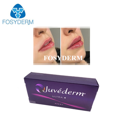 Koreański kwas hialuronowy łączy się ze skórą Juvederm Wstrzykiwanie wypełniacza warg