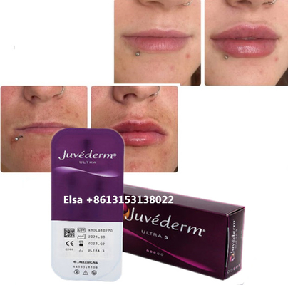 Kosmetyki Pielęgnacja skóry Wstrzykiwania Plumper warg Juvederm Filler Injection For Nose Chin Lip