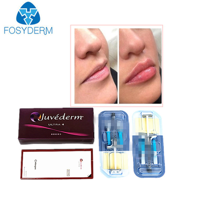 Juvederm hialuronowy kwas przepełniony skórny przepełnienie skórne