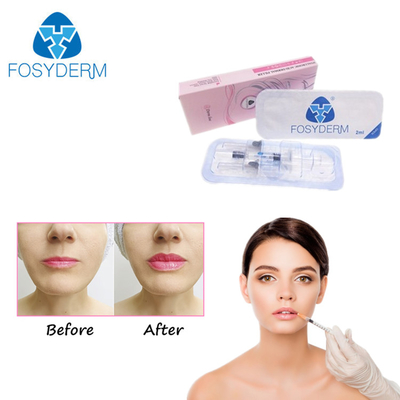 Usieciowany żel do wstrzykiwań Kwas hialuronowy Wypełniacz skórny Anti Aging CE ISO