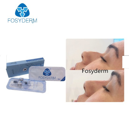 Fosyderm Usieciowany Deep Line Filler 2 ml Wypełniacz skórny do nosa w górę