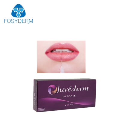 Lip Juvederm Ultra 3 Kwas hialuronowy Wypełniacz skórny 2 * 1ml