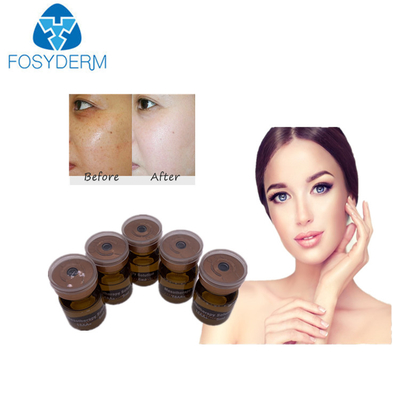 20mg / ml 5ml Mezoterapia Serum Wybielające Roztwór Meso