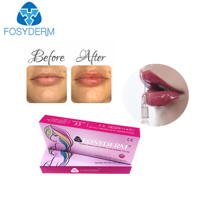 1ml wypełniacze do ust z kwasem hialuronowym Derm Lip Enhancement Injection dla kobiet