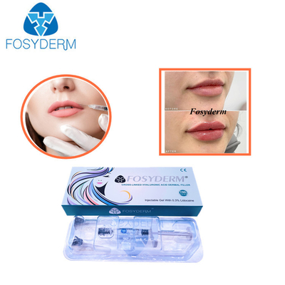 1.1 ml Derm Line Kwas hialuronowy do wstrzykiwania wypełniacza skórnego Lip Enhancement