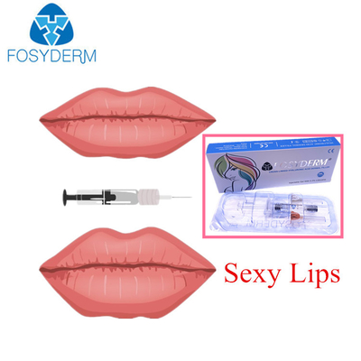 Fosyderm Wypełniacz skórny z kwasem hialuronowym do wypełniania ust 2 ml głębokiej linii