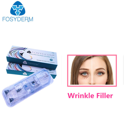 1,1 ml zastrzyków do twarzy na zmarszczki HA Dermal Filler