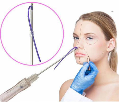Korea MONO Screw PDO Thread Lift Lifting Face Lifting Pdo Thread With Needle