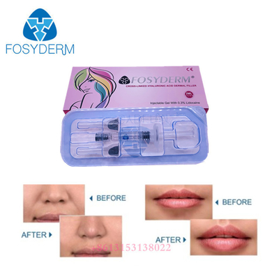 Zmarszczki twarzy Ha Gel Dermal Filler Wstrzykiwalny wypełniacz z kwasem hialuronowym do ust