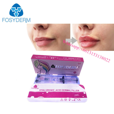 OEM Lip Enlargement Kwas hialuronowy Dermal Filler Gel Injection