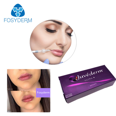 Ultra3 Ultra4 Voluma Kwas hialuronowy Wypełniacz skórny Żel Juvederm Lip Filler 24 mg / ml
